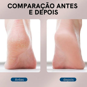 EasyClean - Lixa Removedora de Calos Recarregável Portátil [Versão 2024]