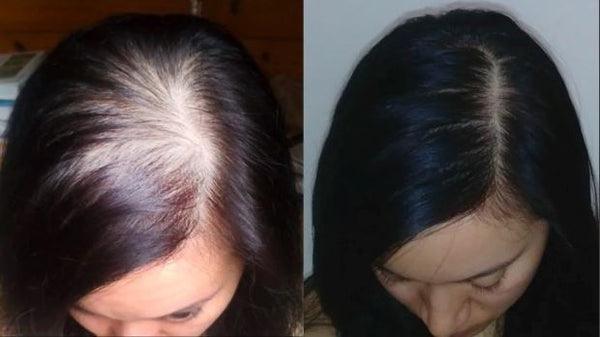 Escova Laser Belahair™ Anti queda de Cabelos - BrasaDescontos